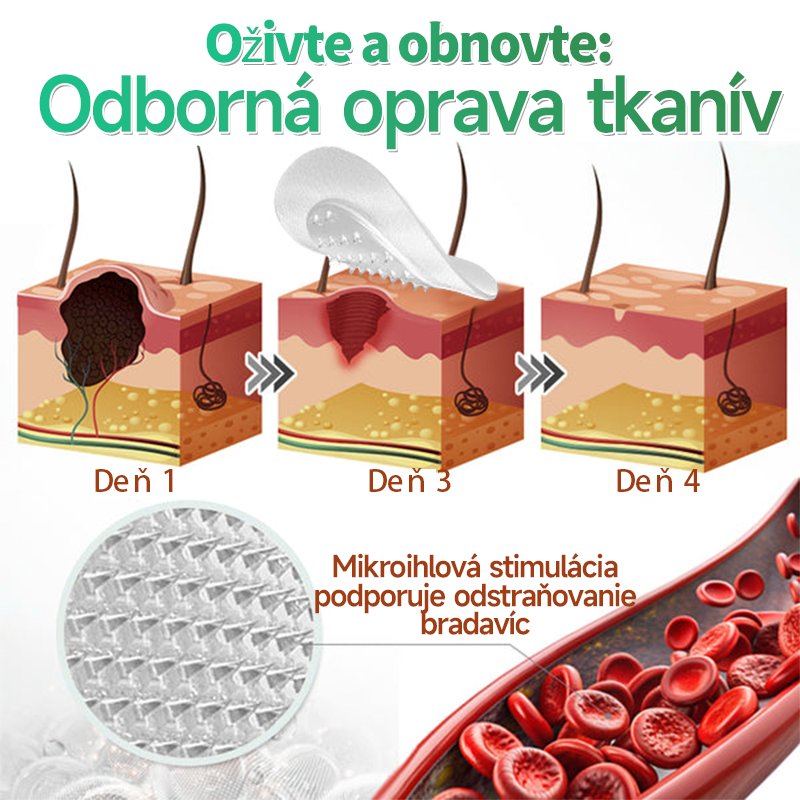Hudros® hydrokoloidné náplasti s mikroihličkami (144 ks)